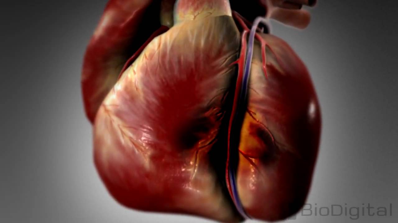 Hjärtattack -har du fått en hjärtinfarkt? Orsak & symptom hjärtattacker
